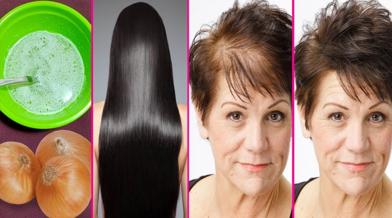 How To Grow Long Thick Hair With Onion Juice, Hair Regrowth Using Onion Juice, Hair Fall Control