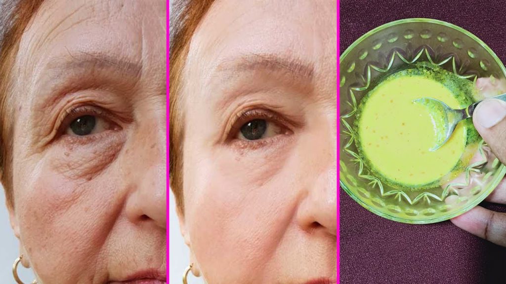 Most Effective Yogurt Anti Aging Face Pack / Get Wrinkles Free Younger