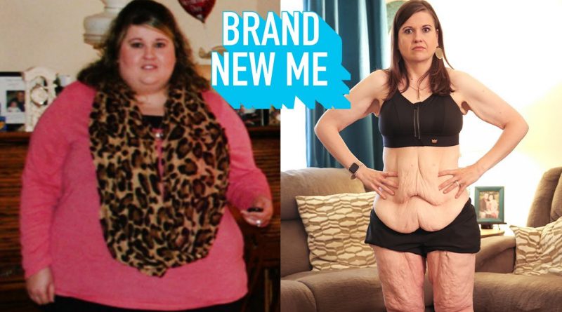 My 260lbs Weight Loss Left Me With 20lbs Of Loose Skin | BRAND NEW ME