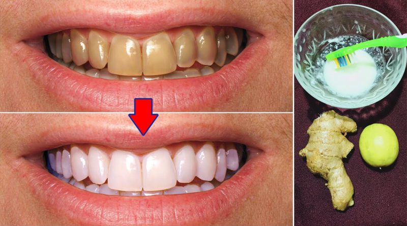 Natural Ways To Whiten Your Teeth At Home In 3 Minutes, Magical Teeth Whitening Remedy