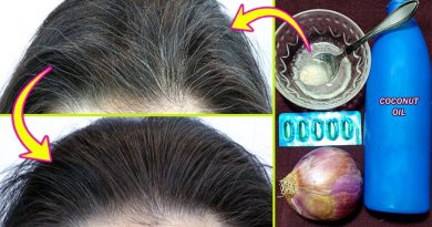 Get Rid Of White Hair Naturally At Young Age - Best Home Remedy For Gray Hair Turns Into Black Fast
