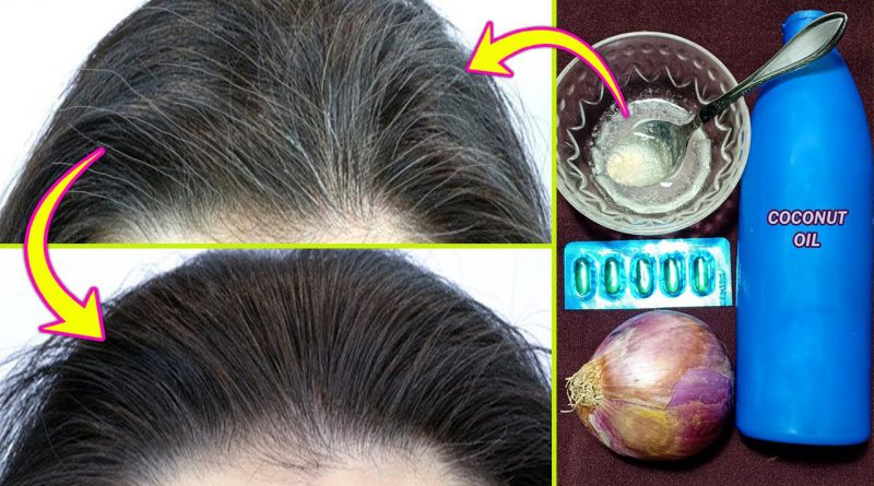 Get Rid Of White Hair Naturally At Young Age - Best Home Remedy For Gray Hair Turns Into Black Fast