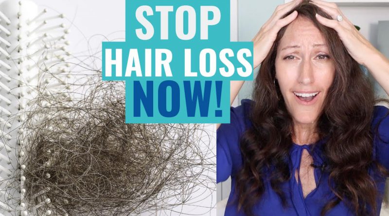 Homeopathics for Telogen Effluvium that STOP Hair Loss Naturally