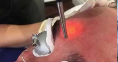 Laser Hair Removal Male Grooming
