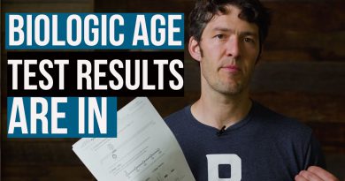MyDNAage Test Result Review (I'm older than my actual age)