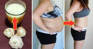 NO STRICT DIET NO WORKOUT - Super Fast Weight Loss Remedy - Lose Weight Fast With Garlic