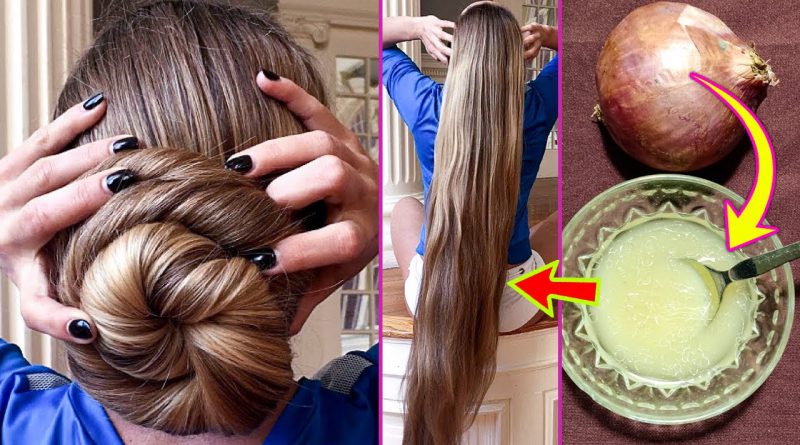 Onion Juice For Hair Growth With Ginger And Coconut Oil, Benefits Of Onion Juice For Hair