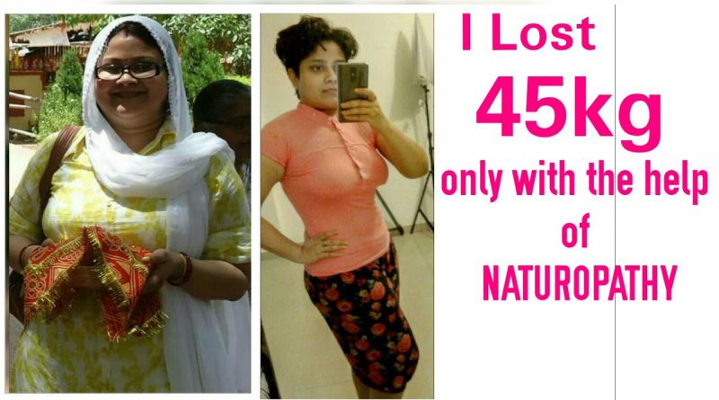 my weight loss journey, weight loss transformation, Weight loss motivation, before and after