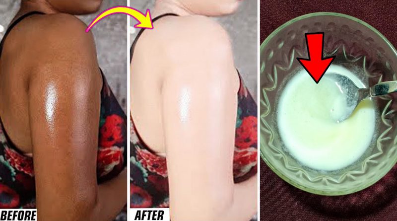 Get Instant Glowing Skin In 20 Minutes - Instant Fairness Face Pack | Instant Skin Lightening