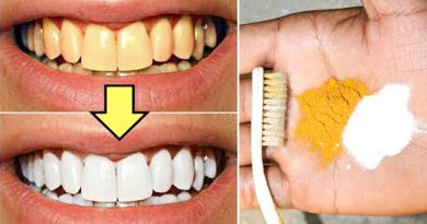 HOW TO MAKE TEETH WHITER IN JUST 2 MINUTES | MAGICAL TEETH WHITENING REMEDY | 100% EFFECTIVE