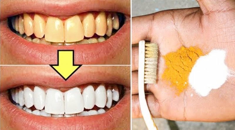 HOW TO MAKE TEETH WHITER IN JUST 2 MINUTES | MAGICAL TEETH WHITENING REMEDY | 100% EFFECTIVE