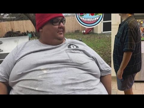 One man's extreme weight loss journey