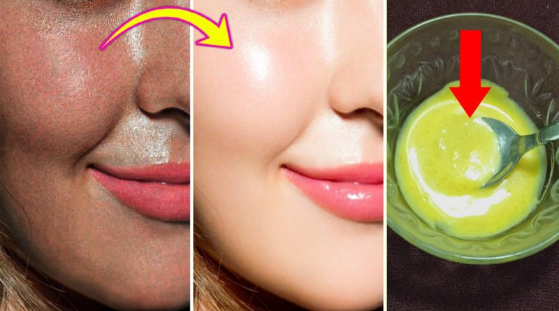 Amazing Skin Whitening Face Mask - Get Fairer And Glowing Skin Only 20 Minutes