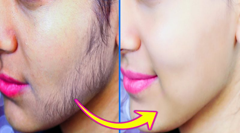 Best Way To Remove Facial Hair Permanently At Home Using Turmeric Powder