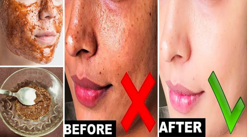 Cinnamon And Honey Face Pack, Get Clear Glowing Skin Naturally | Skin Whitening Pack