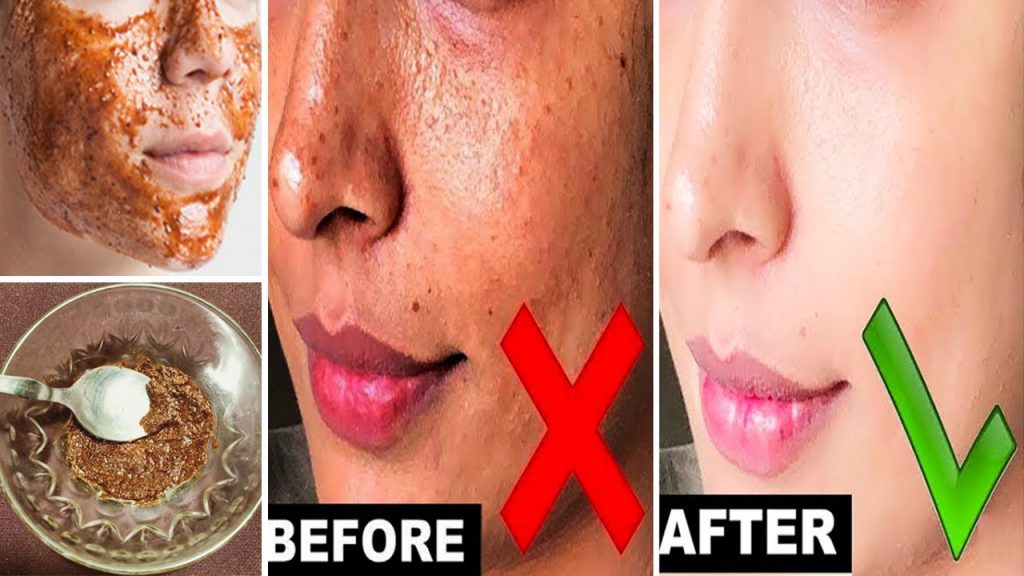 Cinnamon And Honey Face Pack, Get Clear Glowing Skin Naturally Skin
