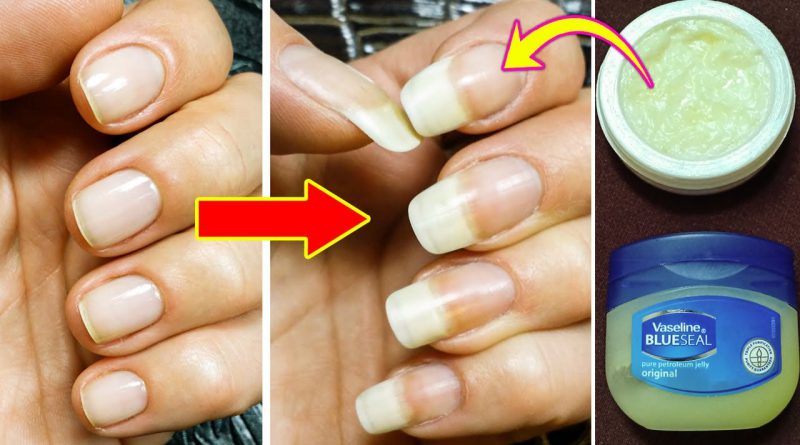 How To Make Your Nails Grow Faster And Stronger, Get Long And Strong Nails In A Week