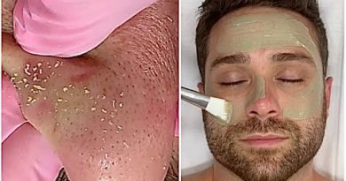 Male Grooming Deep Cleanse Facial {Pimples, Long Massage, Guided Meditation} @JadeyWadey 180
