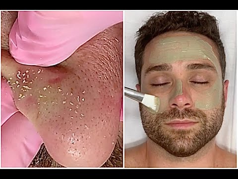 Male Grooming Deep Cleanse Facial {Pimples, Long Massage, Guided Meditation} @JadeyWadey 180