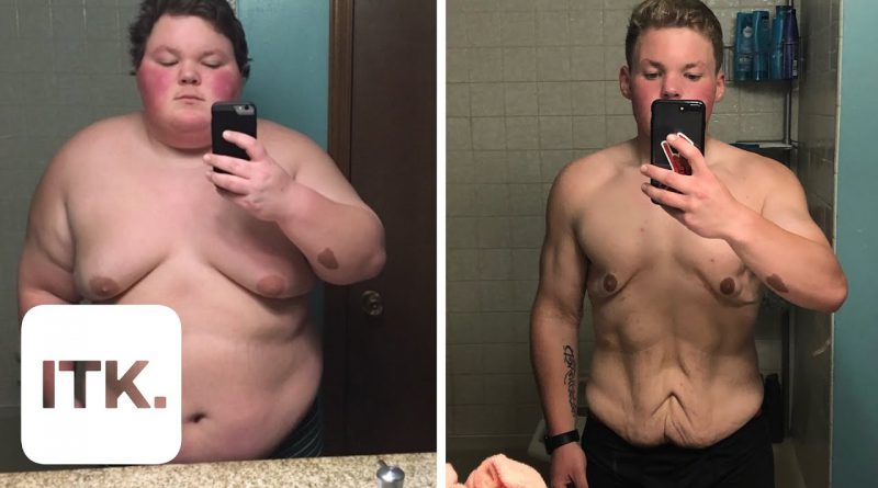 Watch: Bullied boy’s inspiring 189-pound weight loss journey