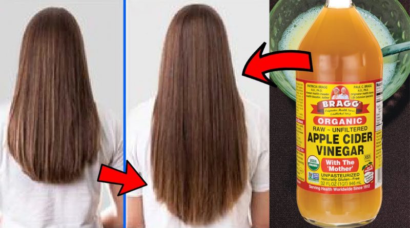 Apple Cider Vinegar For Hair Growth/Apple Cider Vinegar And Egg Hair Mask/Get Long Thick Hair