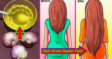 How To Make Onion Hair Oil At Home Your Hair Grow Super Fast And Stop Hair Fall Immediately