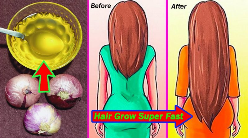 How To Make Onion Hair Oil At Home Your Hair Grow Super Fast And Stop Hair Fall Immediately