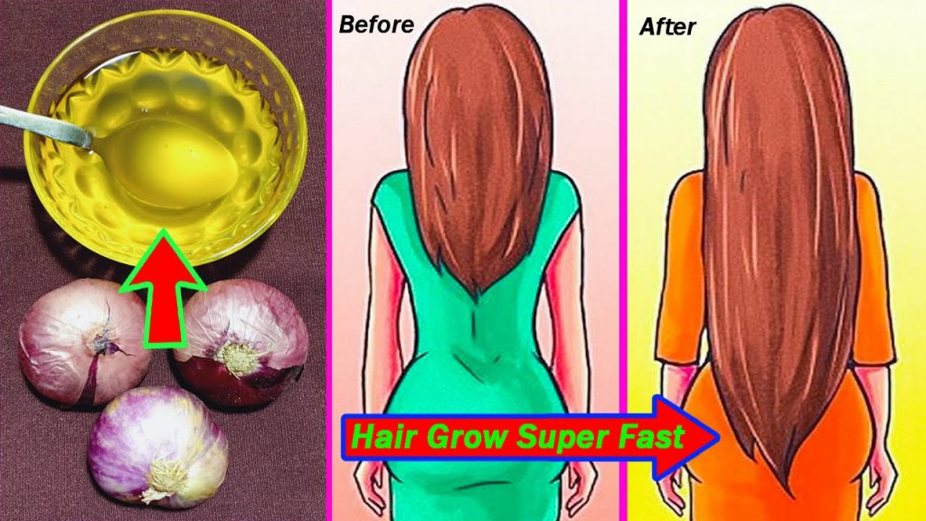 How To Make Onion Hair Oil At Home Your Hair Grow Super Fast And Stop