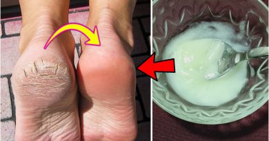 Remove Cracked Heels And Get Pretty Feet In A Week । Cracked Heels Remedy At Home