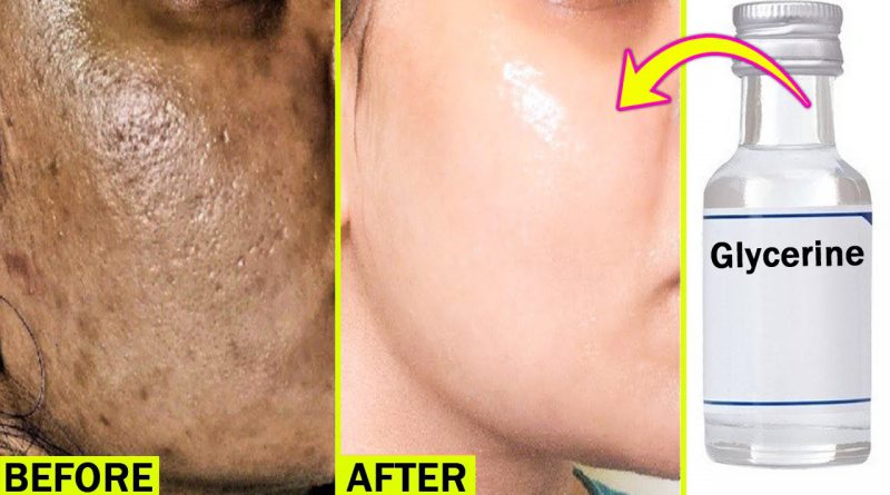 Use Glycerin This Way Your Skin Will Look So Young, Tight, Spotless, And Glowing