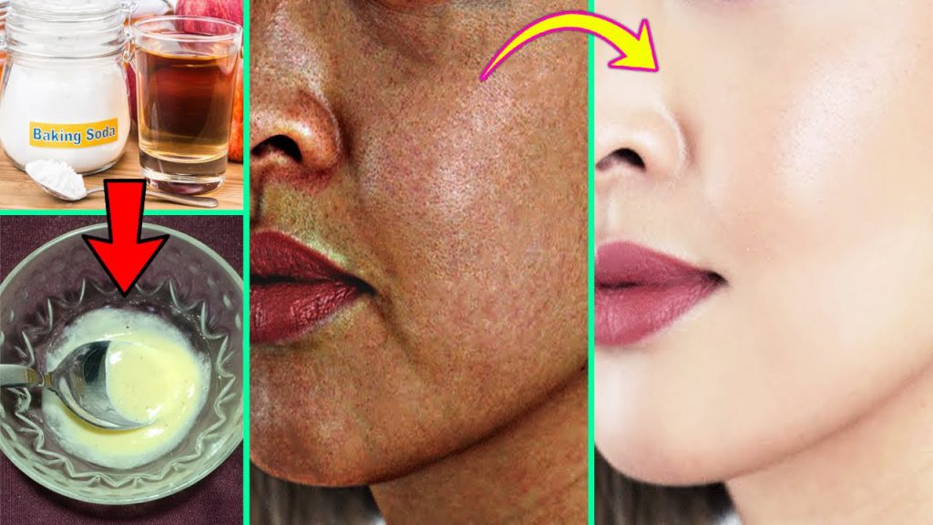 Baking Soda And Apple Cider Vinegar For Skin Whitening, Quick Skin