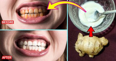 Home Remedy For Whitening Teeth Fast, Get Whiter Teeth With Baking Soda And Ginger