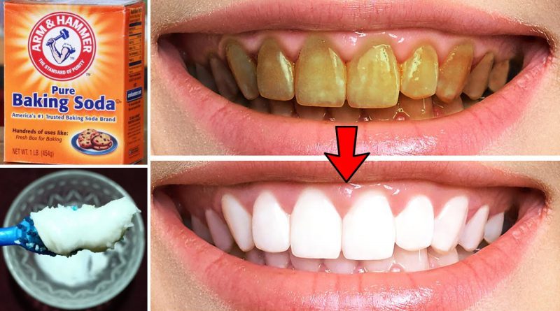 How To Make Teeth Whiter In 3 Minutes, Whitening Teeth With Baking Soda, Best Way To Whiten Teeth