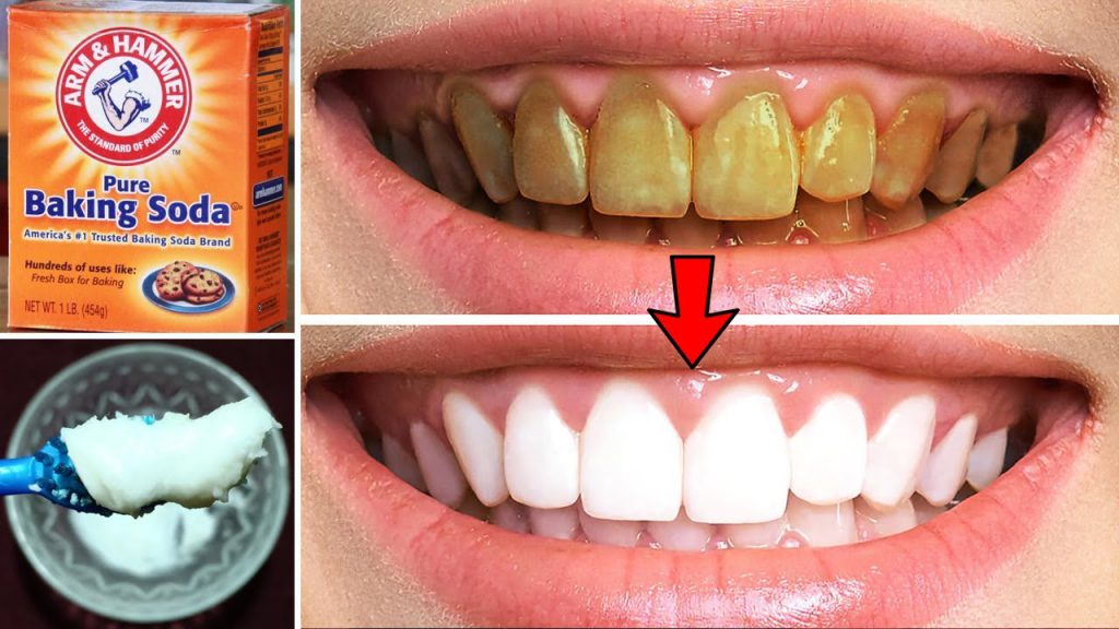 How To Make Teeth Whiter In 3 Minutes, Whitening Teeth With Baking Soda