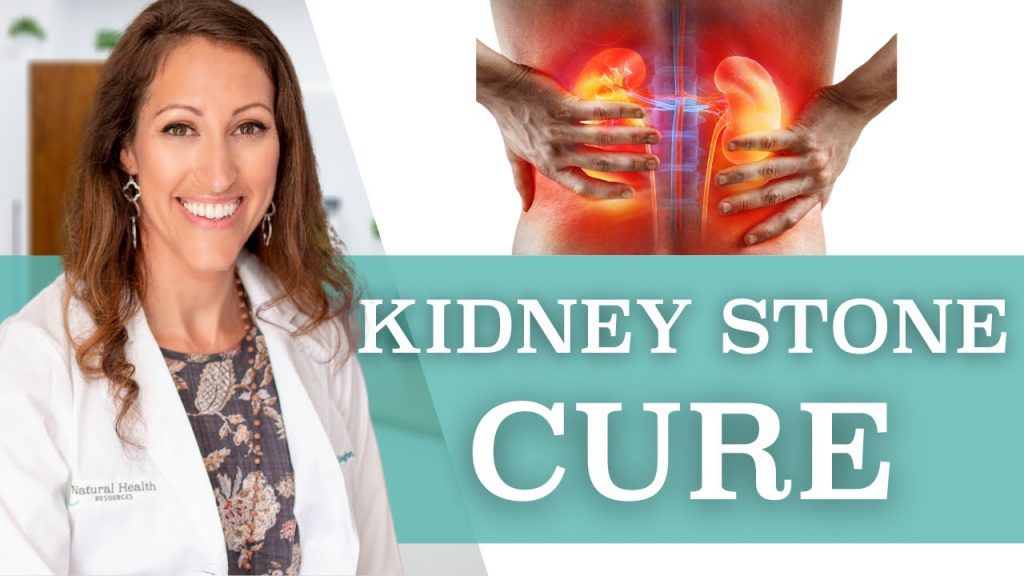 How To Get Rid of Kidney Stones FAST At Home