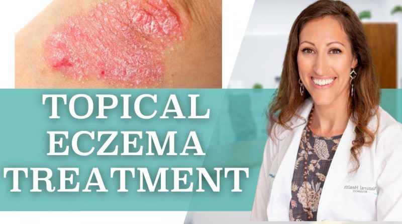 How to Treat Eczema Topically at Home