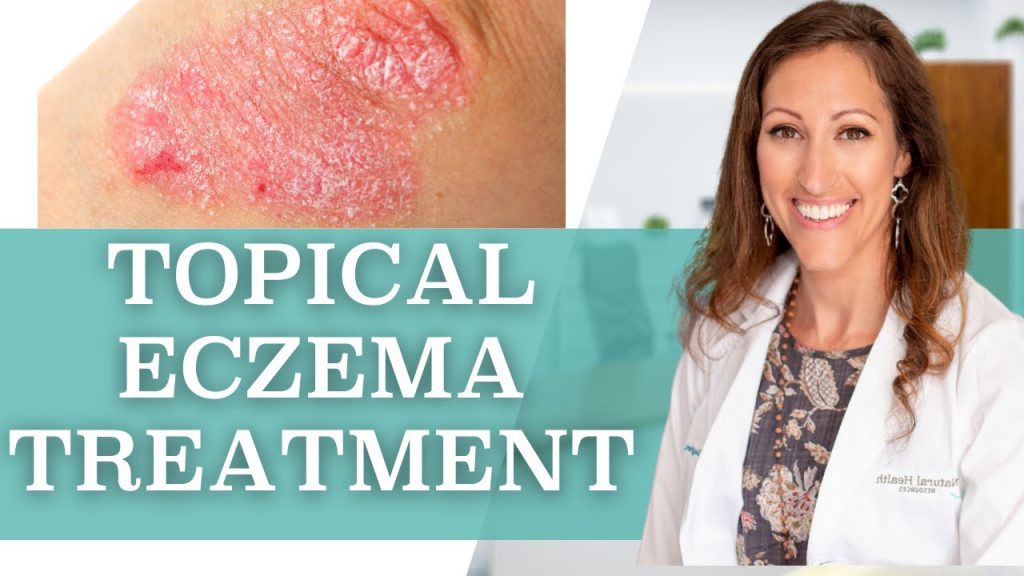 How to Treat Eczema Topically at Home